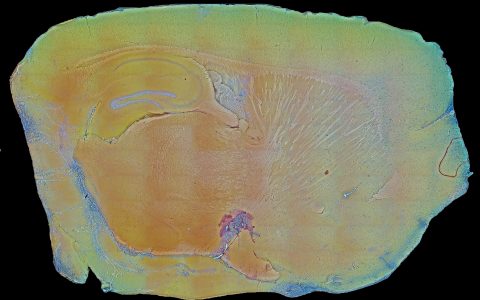 Sagittal mouse brain cross-section collected using MUSE
